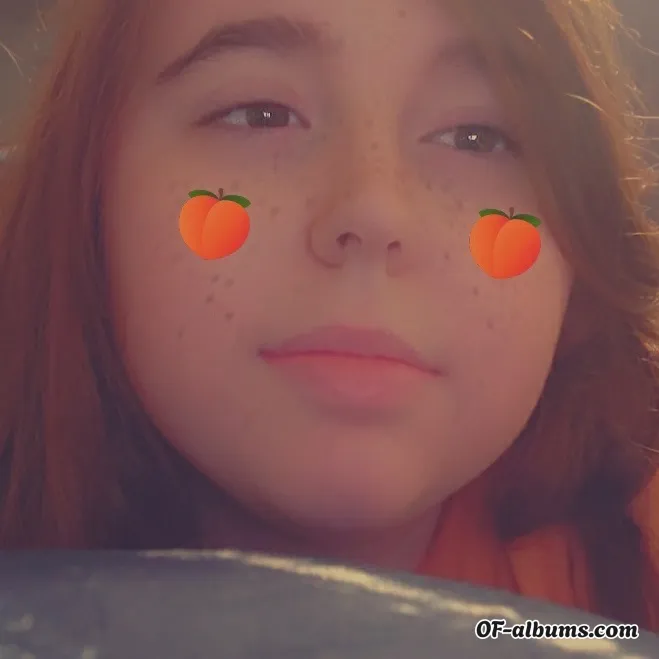 Image #1 of cherrychapstickk1