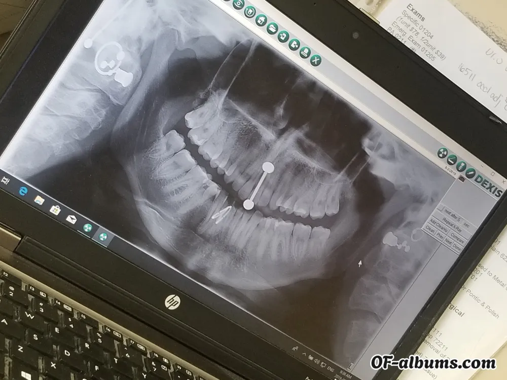 Image #2 of chronicyoshi