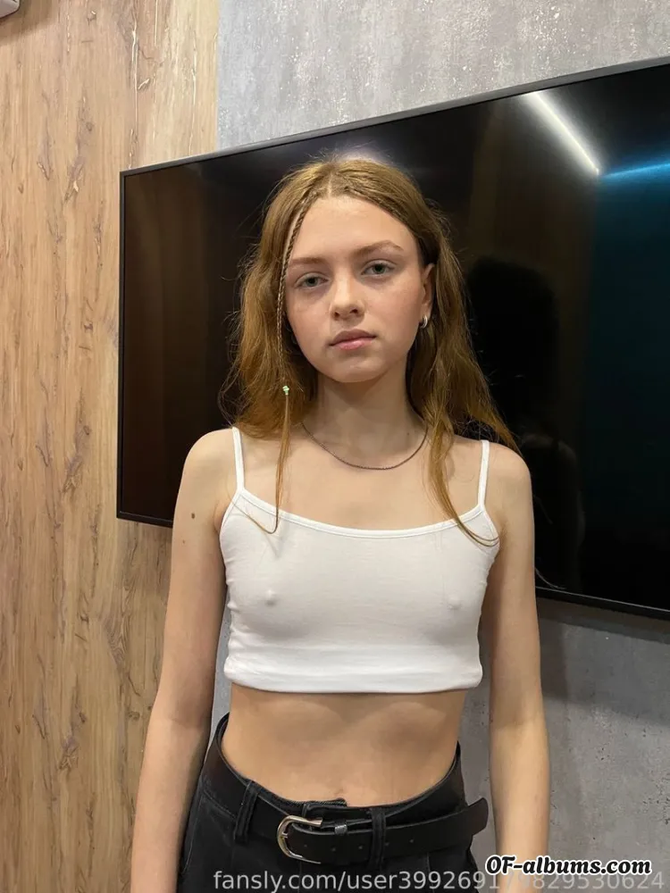 Image #1 of freckles