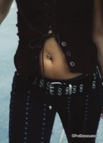 Image #3 of mssynn