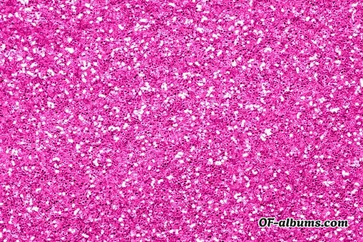 Image #2 of poiison.ivvy