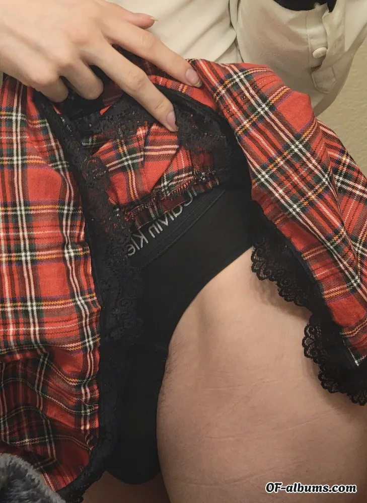 Image #2 of urownmigraine