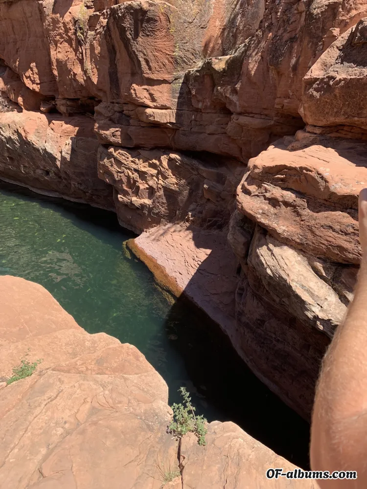 Image #2 of vitiligohomo